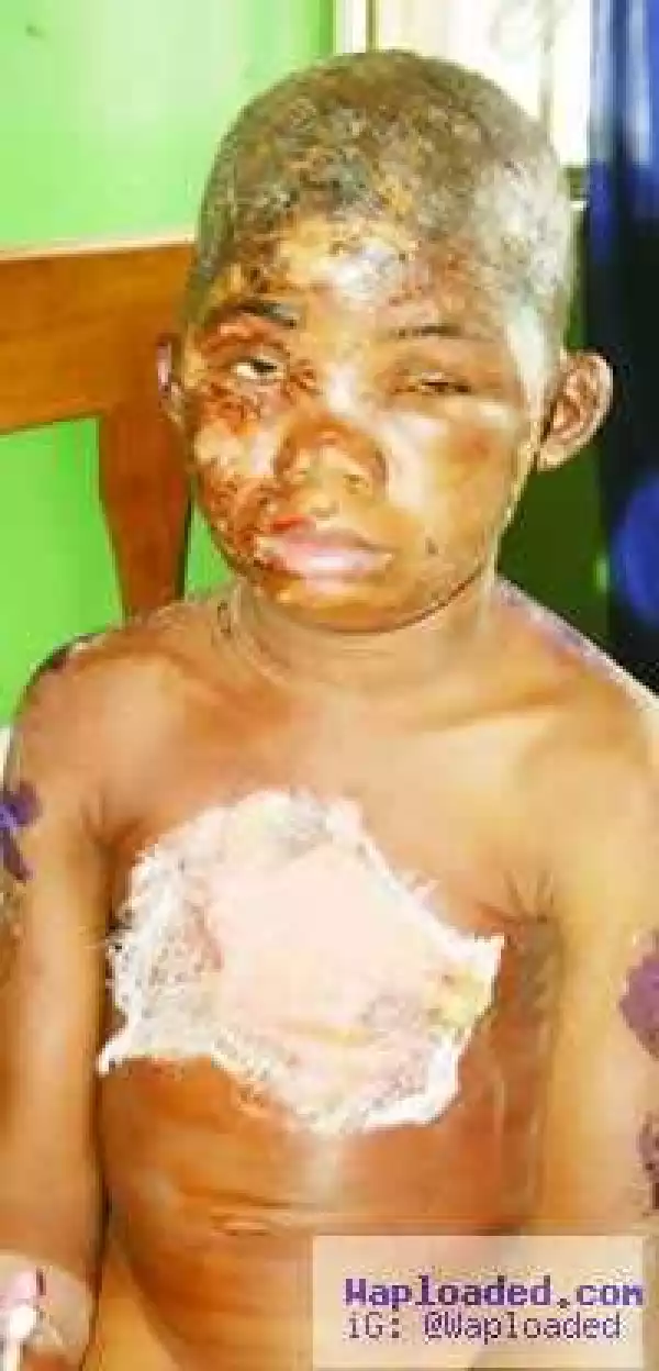 Woman Tortures 9-year-old Housemaid with Hot Water for ‘Stealing’ Crayfish